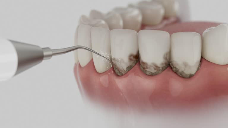 Reliable Dental Implants contractor in Prince Frederick, MD by Smile Center Dentistry